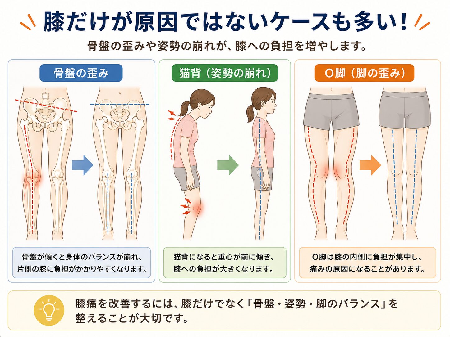 膝痛と姿勢の関係イメージ|甲賀市