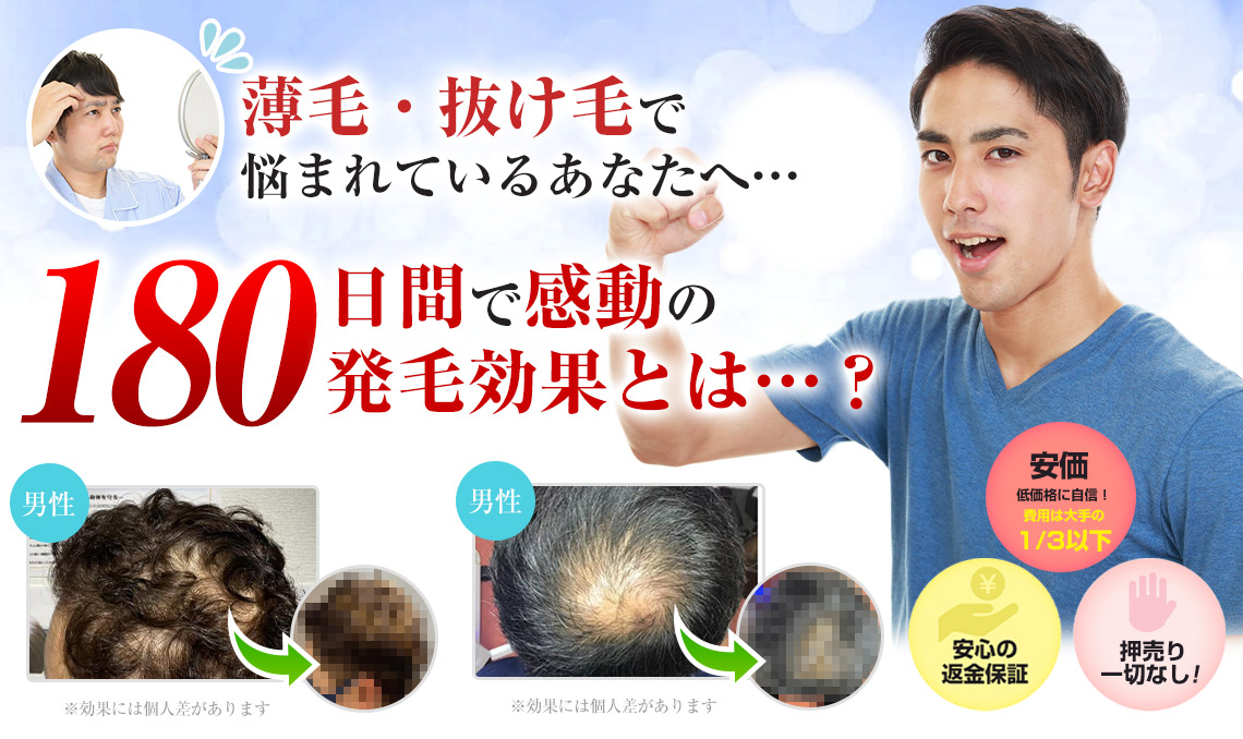 薄毛・抜け毛で悩まれているあなたへ…180日間で感動の発毛効果とは…？