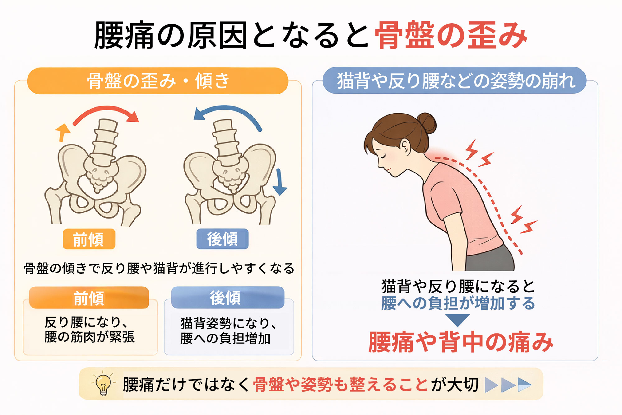 腰痛の原因となる骨盤バランスの崩れ|甲賀市